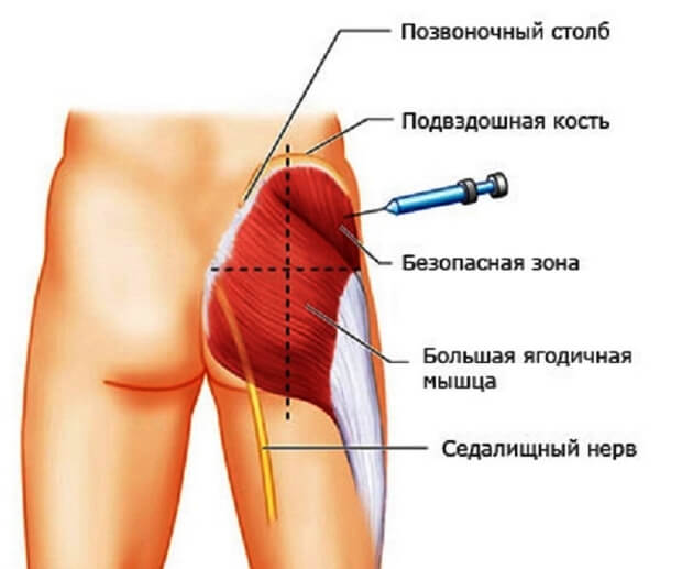 Места