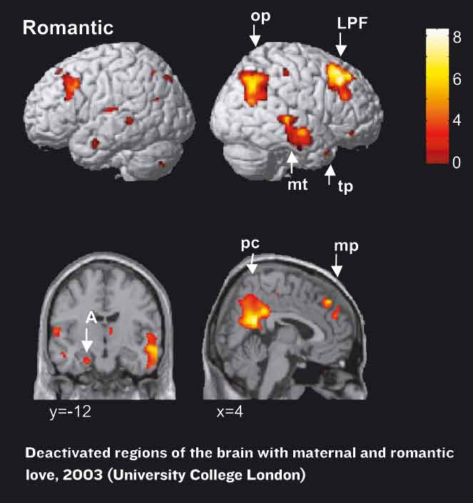 brain scan showing deactivated parts of the brain when people are in love